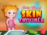 Spielen Baby hazel skin trouble now